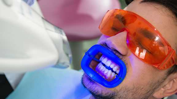 Teeth Whitening Flagstaff, AZ