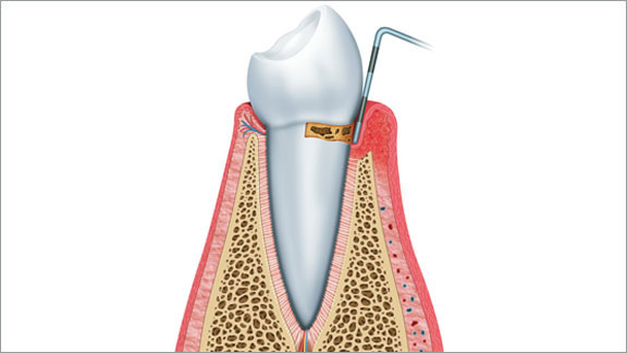 Periodontics Flagstaff, AZ