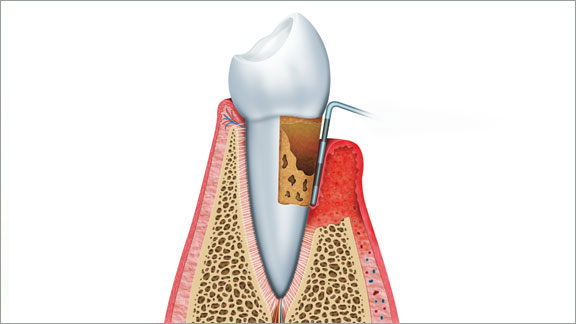 Periodontics Flagstaff, AZ